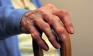 Αρθρίτιδα και αρθρίτιδα των δακτύλων σε ηλικιωμένο άτομο. 